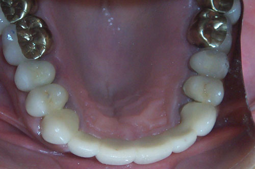 After