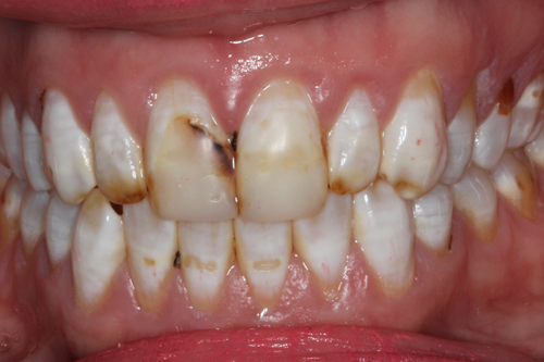 Before