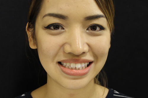 Before